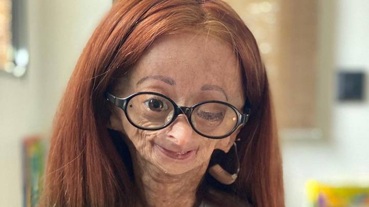 Adalia Rose