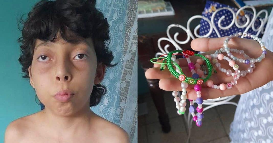 Niño cubano con cáncer