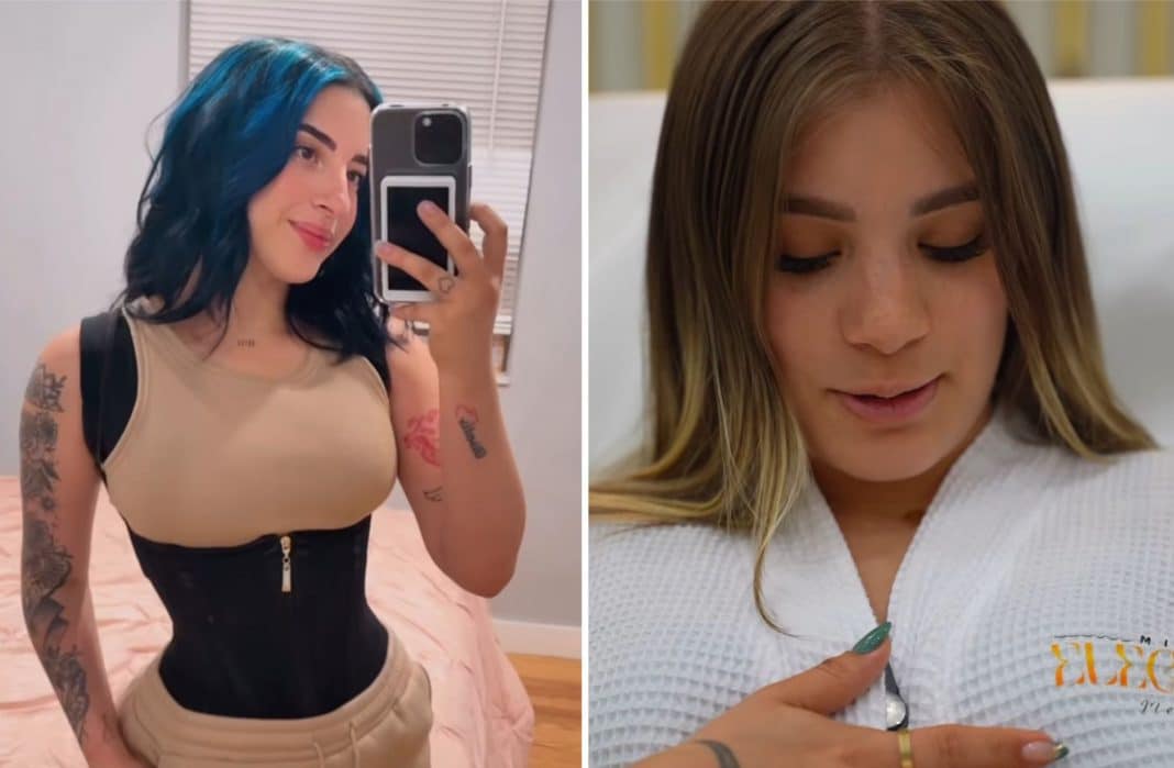 Claudia Artiles se somete a un retoque estético y vuelven las críticas: “Le está copiando todo a Amanda”