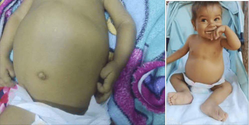 Bebé cubano necesita un transplante de hígado urgente.