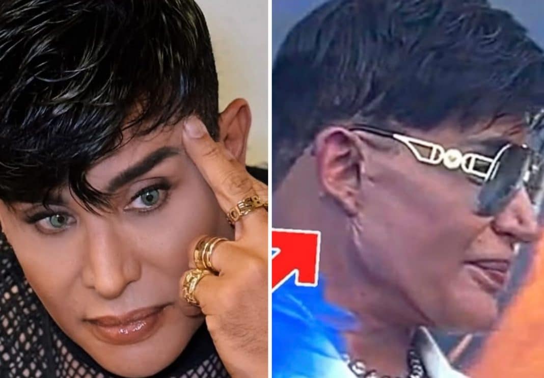 Eduardo Antonio responde a foto viral de su rostro tras cirugía plástica: “Aclarando para los envidiosos”