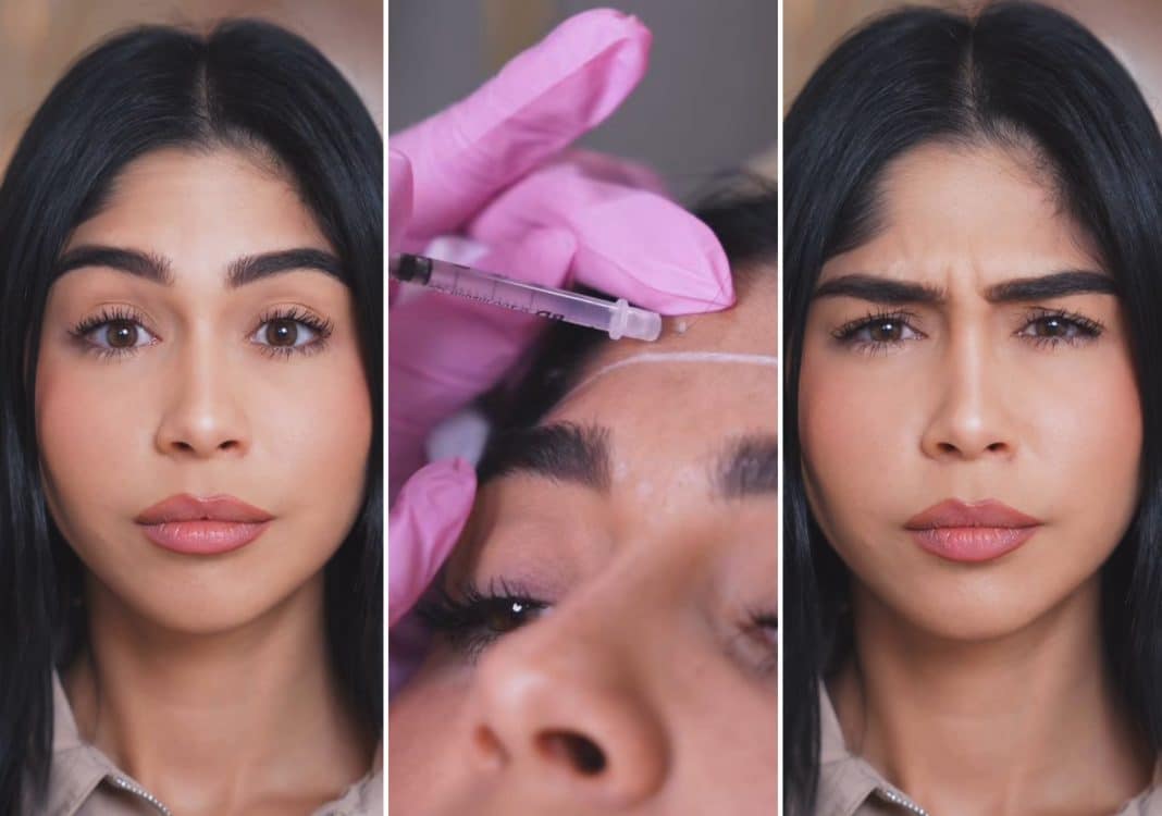 Critican a Daniela Reyes por su último retoque estético: “Llegan a EE.UU y todas empiezan a hacerse lo mismo”