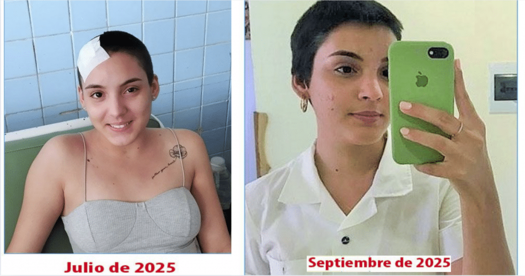 Jovencita cubana es operada del cerebro en Julio y ya regresó a las clases