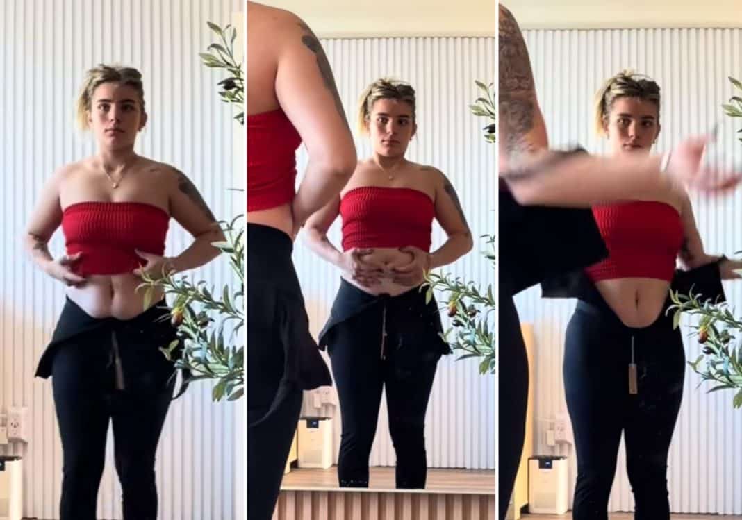 “La barriguita pronto se va”: Claudia Artiles se someterá a una cirugía plástica tras recibir críticas por su cuerpo