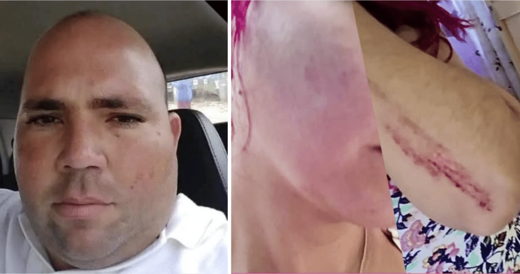 Un hombre golpea a una protectora animalista cubana. Se radica una denuncia en la PNR por Lesiones y Maltrato Animal.