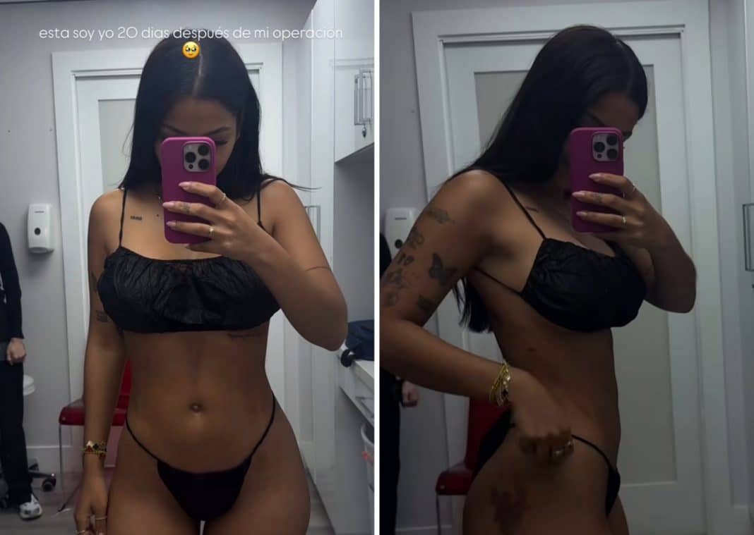Samantha Hernández muestra su cuerpo 20 días después de su cirugía estética