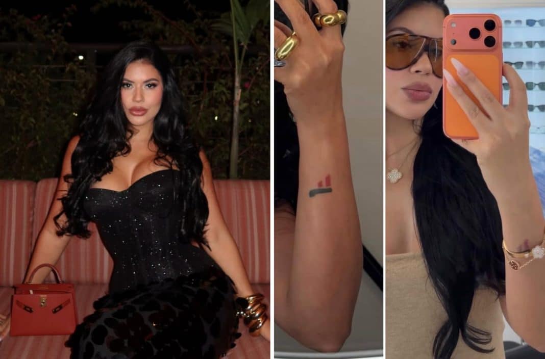 La Dura se borra el tatuaje que se hizo en honor a Jacob Forever