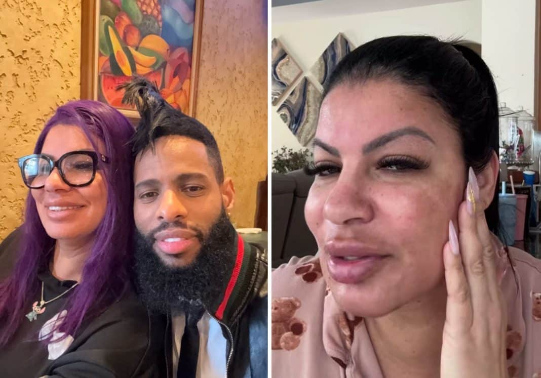 Esposa de El Yonki se somete a un procedimiento en el rostro y queda casi irreconocible