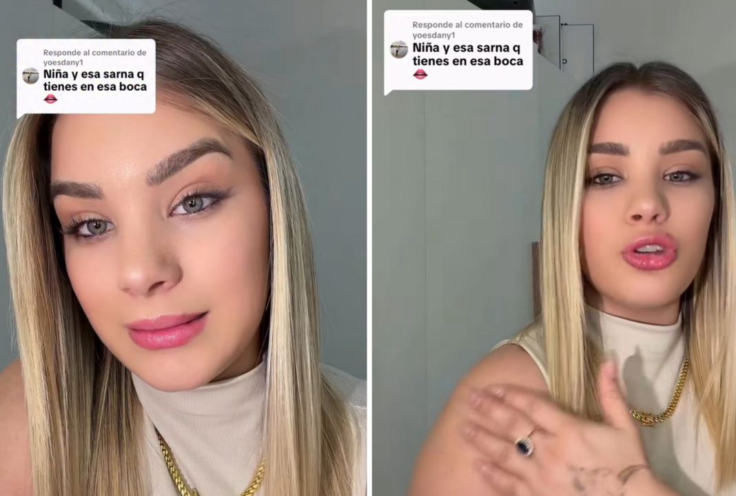 Claudia Artiles habla de los moretones que preocuparon a sus fans: “No tiene nada que ver con Ultrack”