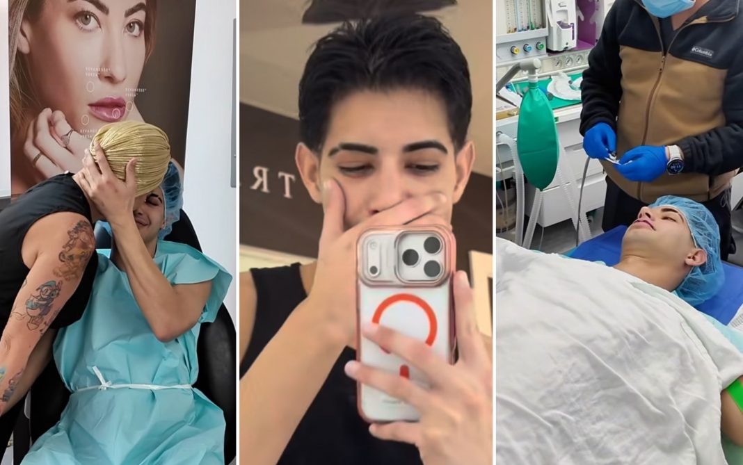 Así le quedaron los labios a Yoel Fashion tras retirarse un peligroso relleno de biopolímero