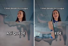 Juliette Valle muestra los resultados de su cirugía plástica y le llueven las críticas: “Regalaste tu dinero” Juliette Valle muestra los resultados de su cirugía plástica y le llueven las críticas: “Quedaste igual que antes”