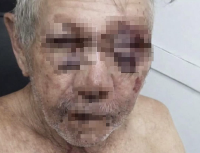 Golpiza a campesino en Cuba para robarle incendia las redes