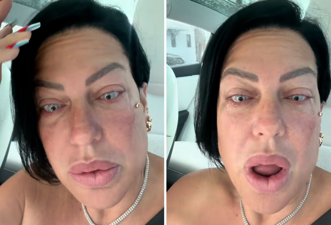 La Diosa gasta 8.000 dólares en retocarse el cambio de color de sus ojos