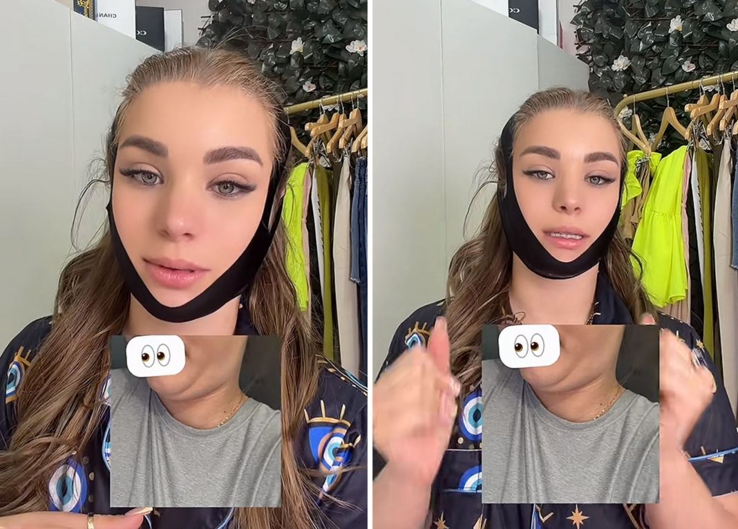 Claudia Artiles se hace un retoque estético para quitarse la papada