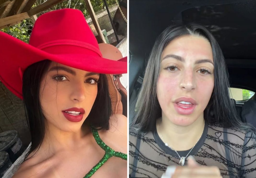 Rachel Arderi cuenta incidente con su rostro