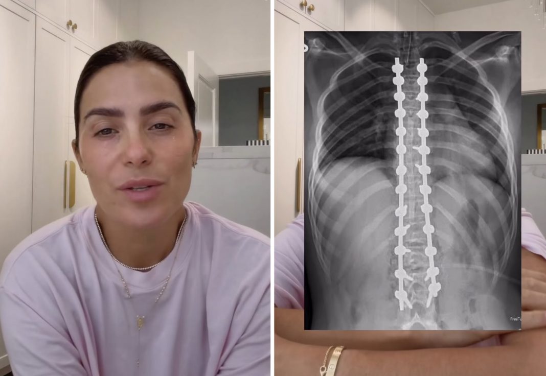 Aly Sánchez habla sobre la cirugía de columna de su hija Sophia: “No quiero dejarla sola”