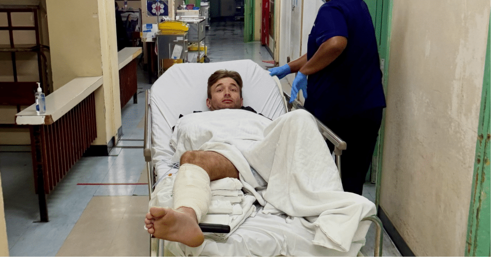 El influencer Henry Gibbs casi pierde una pierna por la mordida de un tiburón