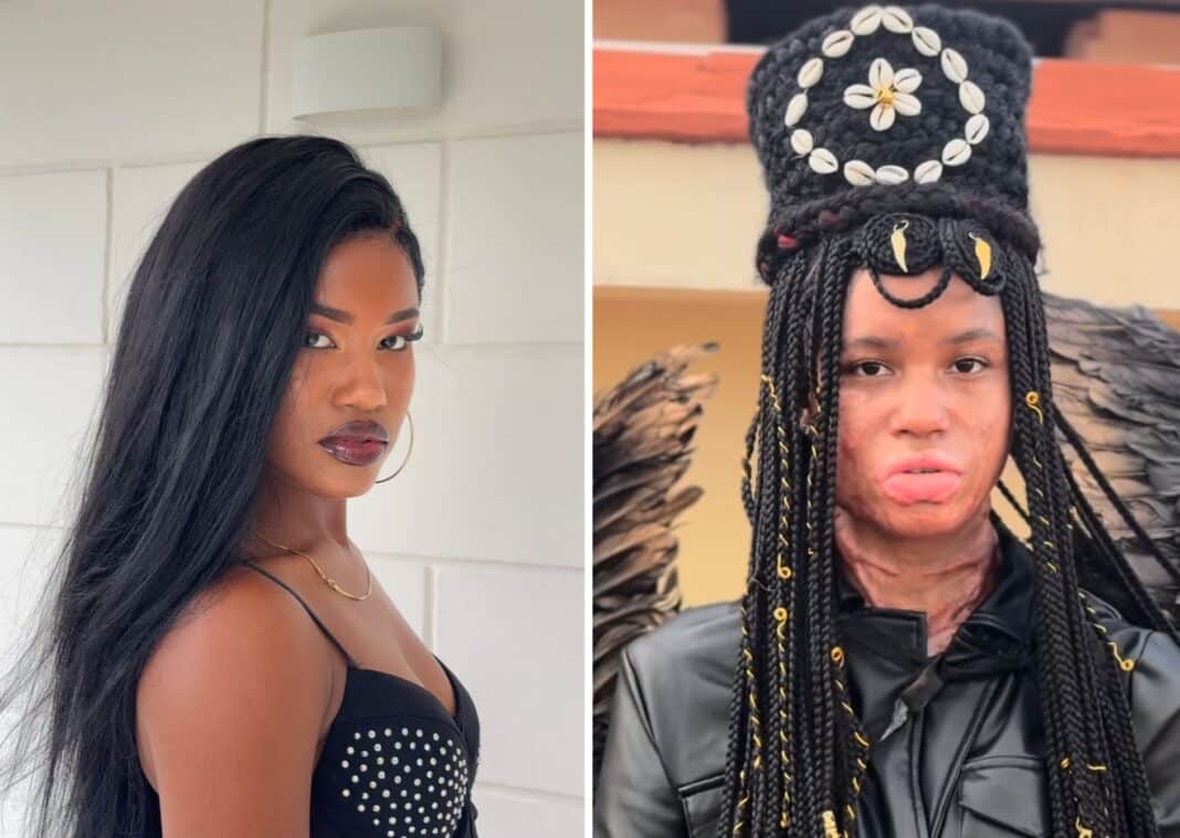 Modelo cubana La Riri vuelve a las pasarelas tras sobrevivir a graves quemaduras